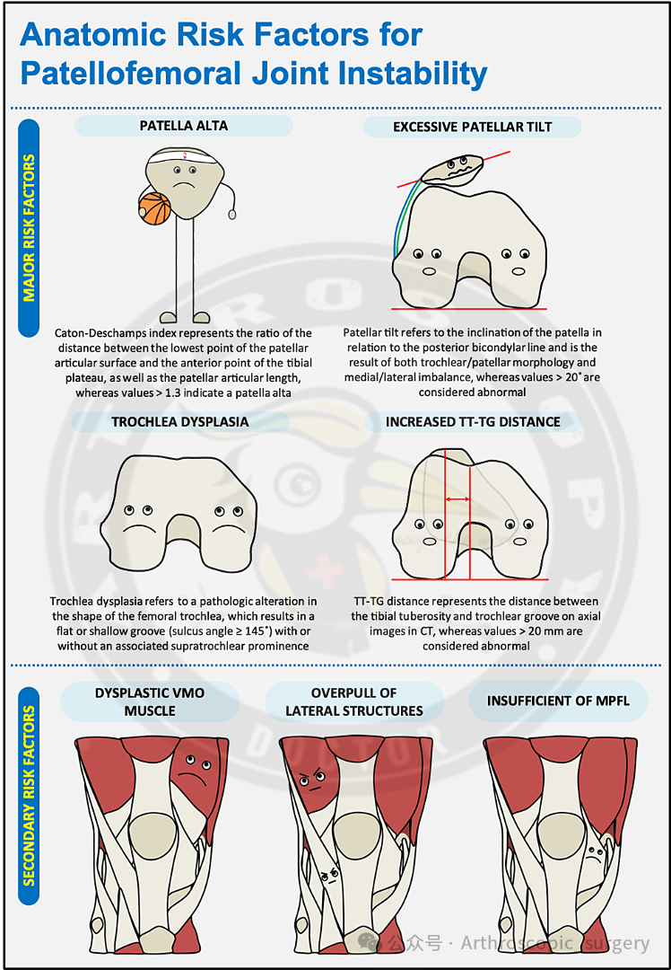 首次髌骨脱位(FTPD)的处理：ESSKA2024专家共识(一)