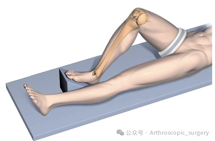 手术技术｜韧带重建技巧：腘绳肌取腱