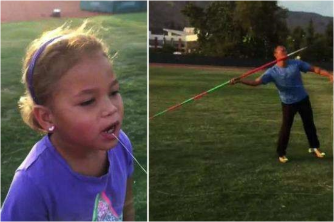 医用钳子怎么拿钳子拔牙、乳牙龋齿……医生：别拿乳牙不当牙，这份护牙“秘笈”请收好~_https://www.jmylbn.com_新闻资讯_第18张