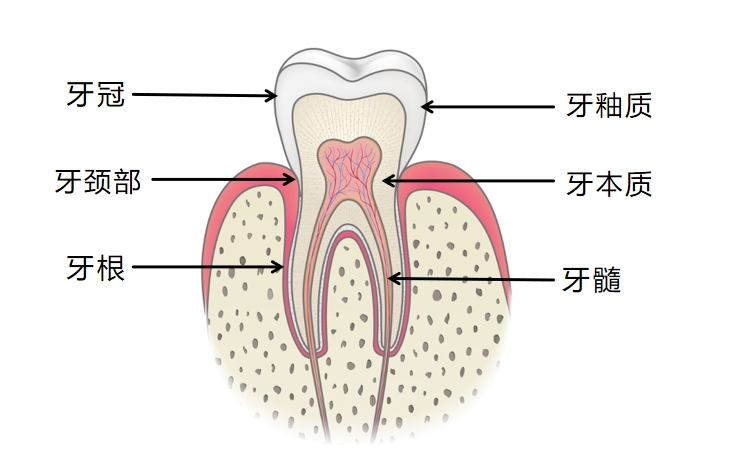 牙胶尖什么颜色港闸医院爱尔口腔｜牙齿发黑很难看？可能是牙髓坏死_https://www.jmylbn.com_新闻资讯_第2张
