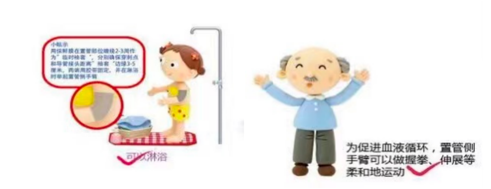 picc导管是什么材质肿瘤患者的血管伴侣----PICC_https://www.jmylbn.com_新闻资讯_第6张