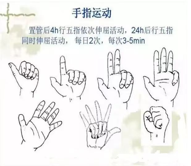 picc导管是什么材质肿瘤患者的血管伴侣----PICC_https://www.jmylbn.com_新闻资讯_第8张