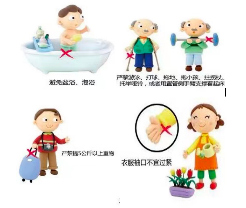 picc导管是什么材质肿瘤患者的血管伴侣----PICC_https://www.jmylbn.com_新闻资讯_第7张