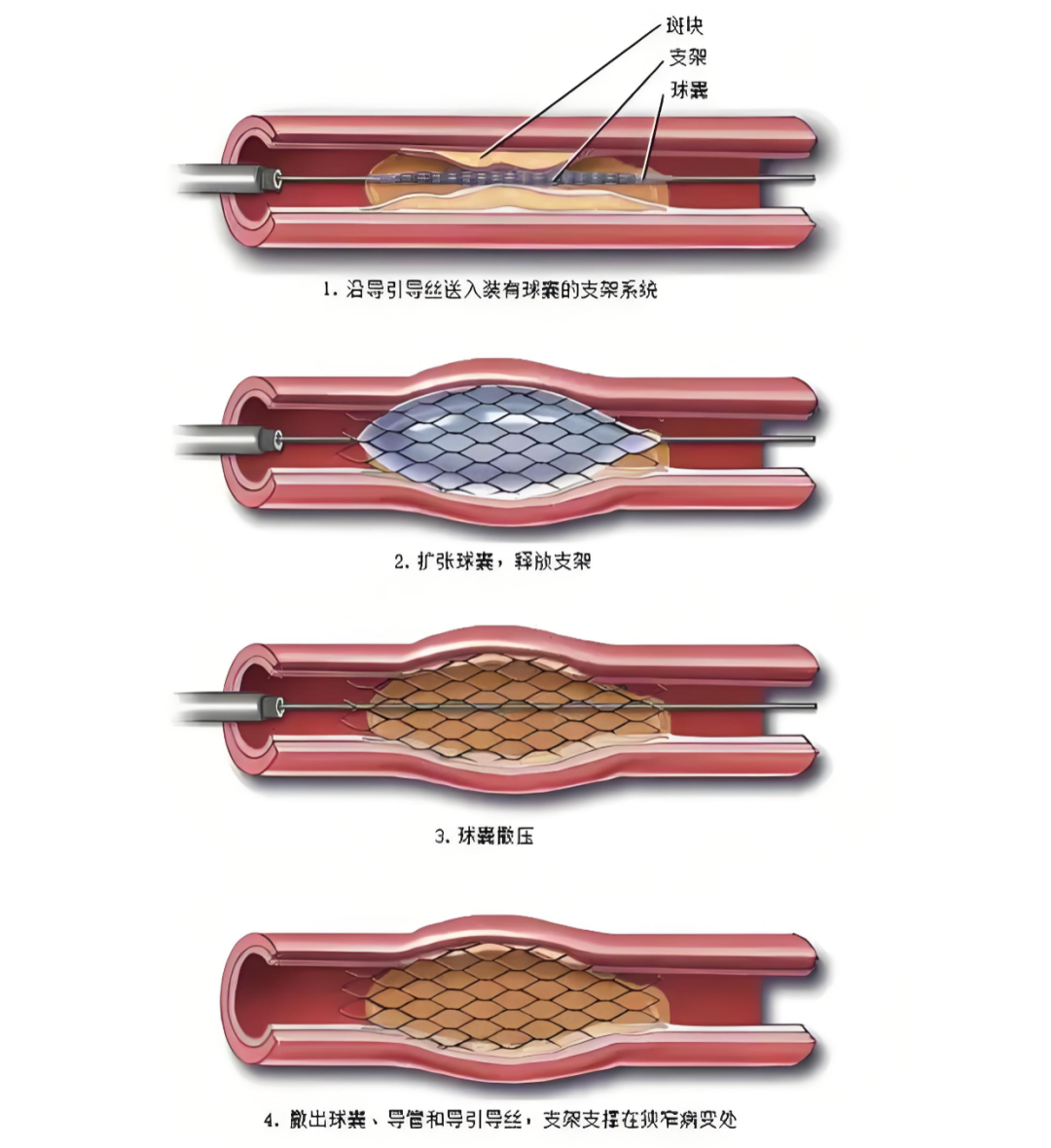 e132ea0609375f394b95f1962613ac15.png