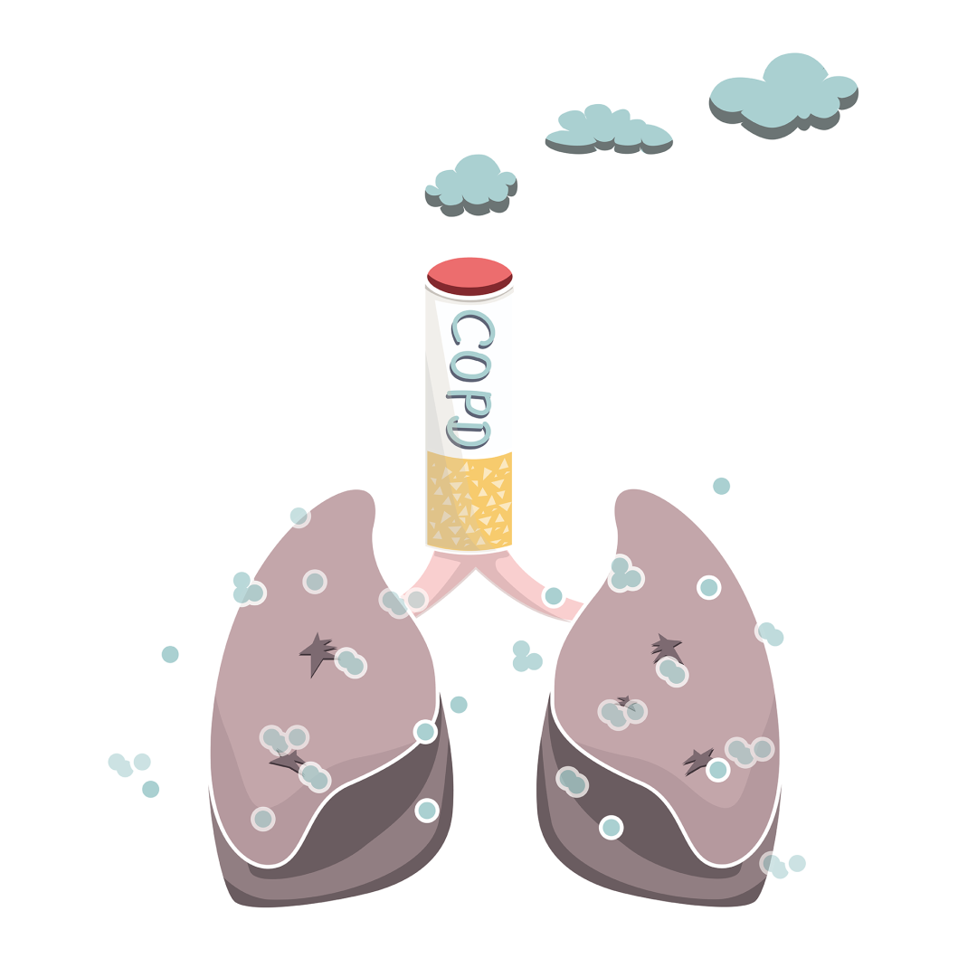 为什么到了夏天慢阻肺更厉害【三高共管、六病同防】老年人慢病防治系列—高血压、糖尿病、脑卒中、慢阻肺防治_https://www.jmylbn.com_新闻资讯_第10张