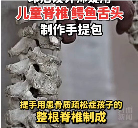 郑爽回应“代孕弃养”，央视痛批！她到底买了谁的子宫？