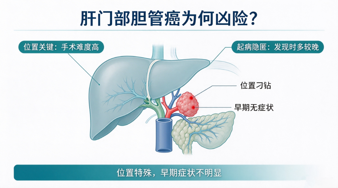 肝门部胆管癌科普配图规划 (1).png