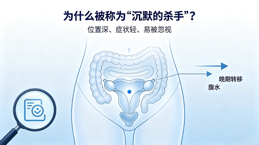 卵巢癌晚期原因及身体变化警示.png