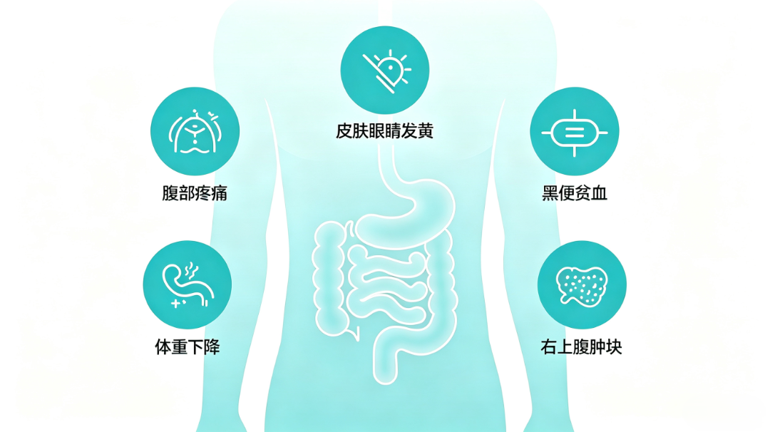男子腹痛竟是十二指肠癌 警惕这些信号.png