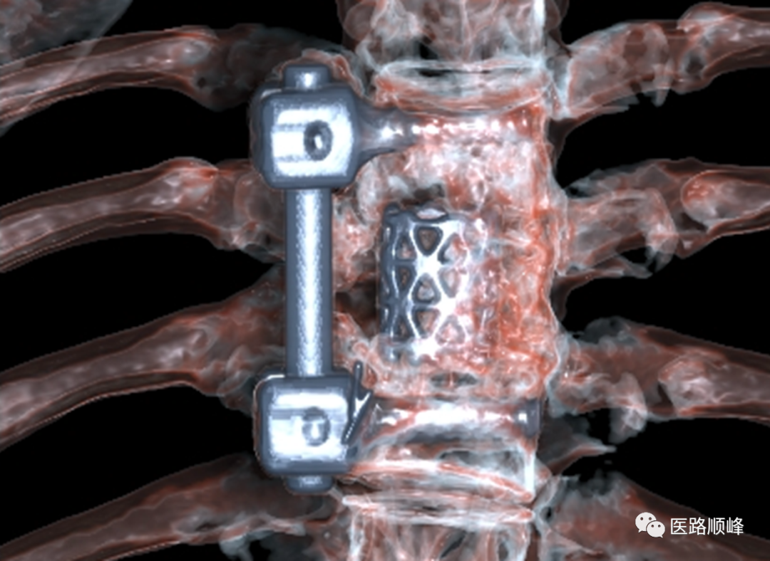 ct为什么需要预热机器Computed Tomography专栏：Incisive CT 球管预热_https://www.jmylbn.com_新闻资讯_第21张
