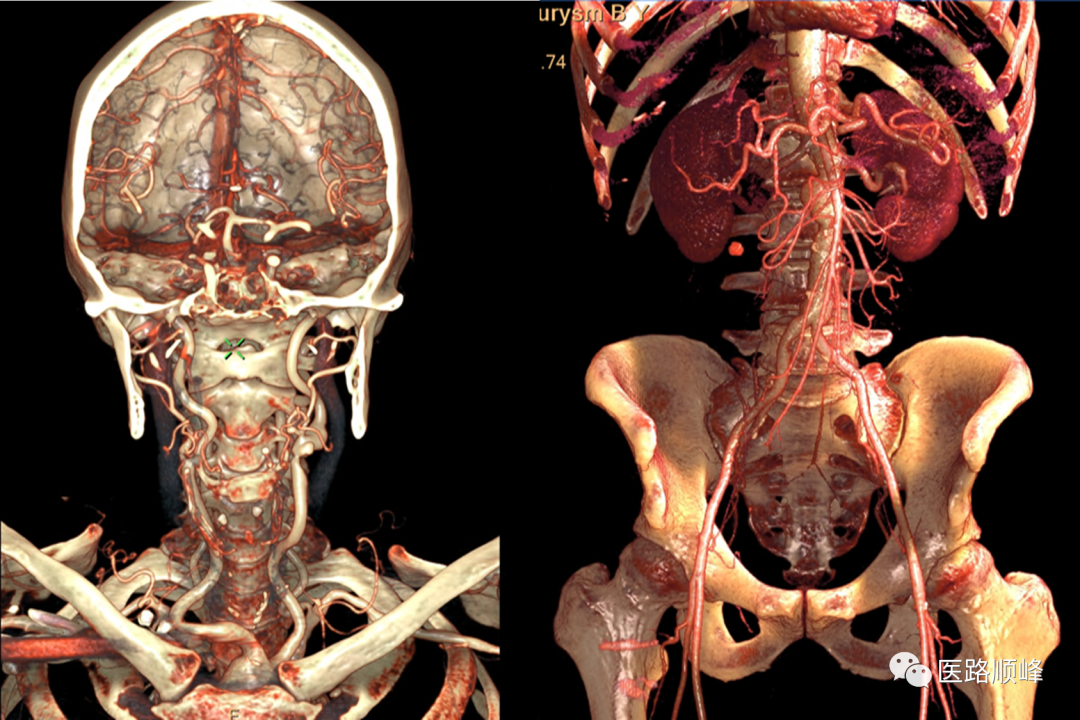 ct为什么需要预热机器Computed Tomography专栏：Incisive CT 球管预热_https://www.jmylbn.com_新闻资讯_第18张
