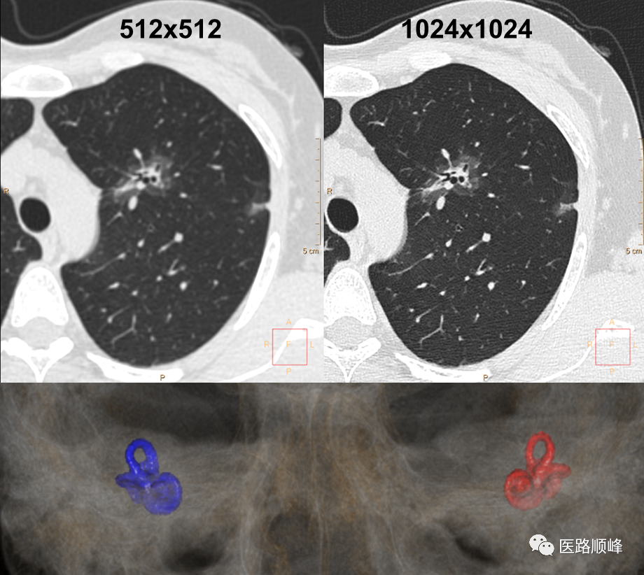 ct为什么需要预热机器Computed Tomography专栏：Incisive CT 球管预热_https://www.jmylbn.com_新闻资讯_第19张