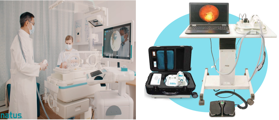 手持眼底相机怎么用全球首款！国产超广角眼科成像系统_https://www.jmylbn.com_新闻资讯_第10张