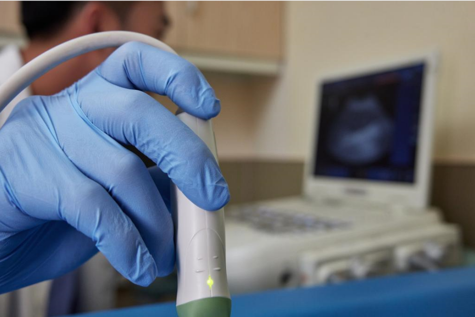 b超为什么探头发热小小的探头，大大的作用，关于B超那些事儿！_https://www.jmylbn.com_新闻资讯_第12张