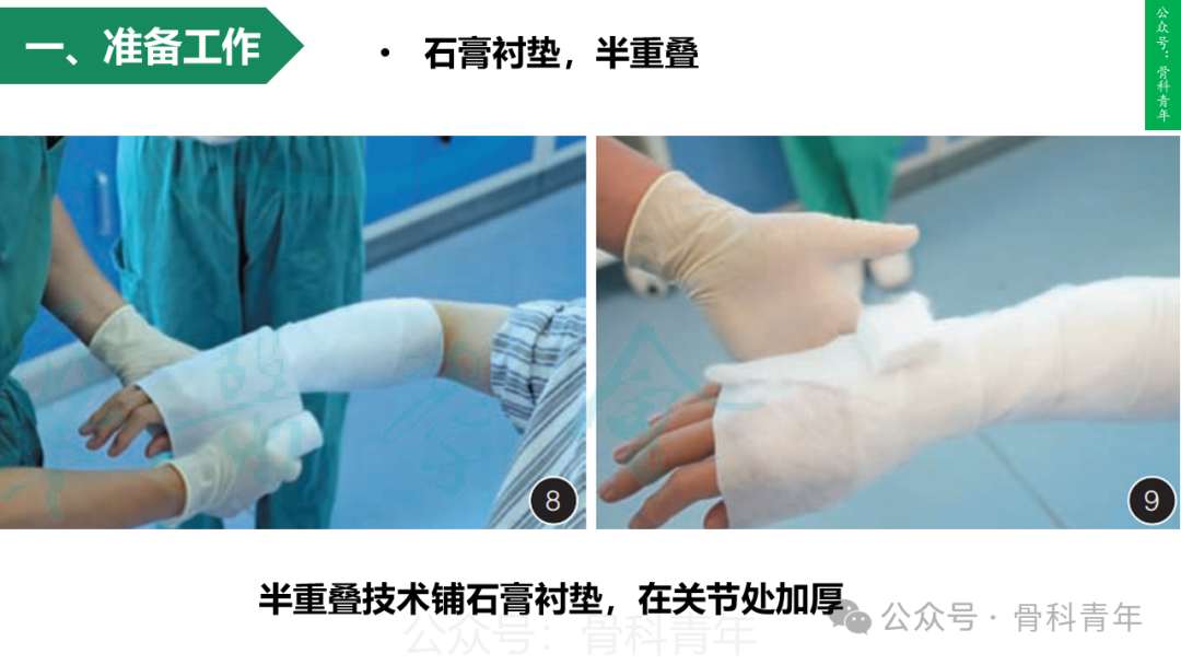积水潭教程：桡骨远端骨折闭合整复石膏固定操作流程