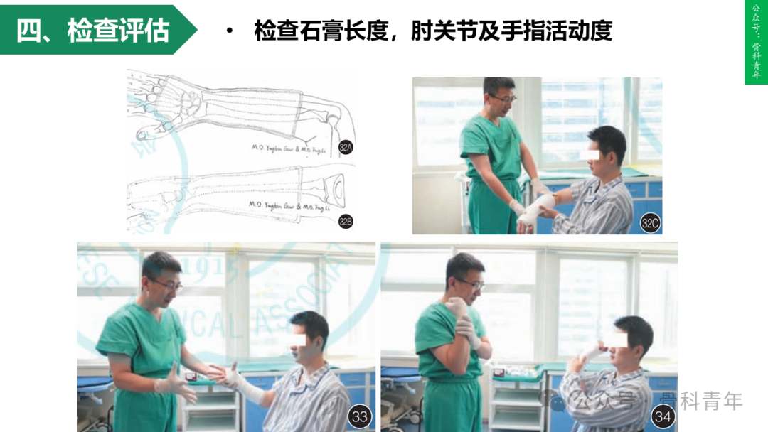 积水潭教程：桡骨远端骨折闭合整复石膏固定操作流程