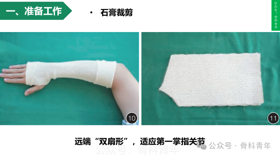 积水潭教程：桡骨远端骨折闭合整复石膏固定操作流程