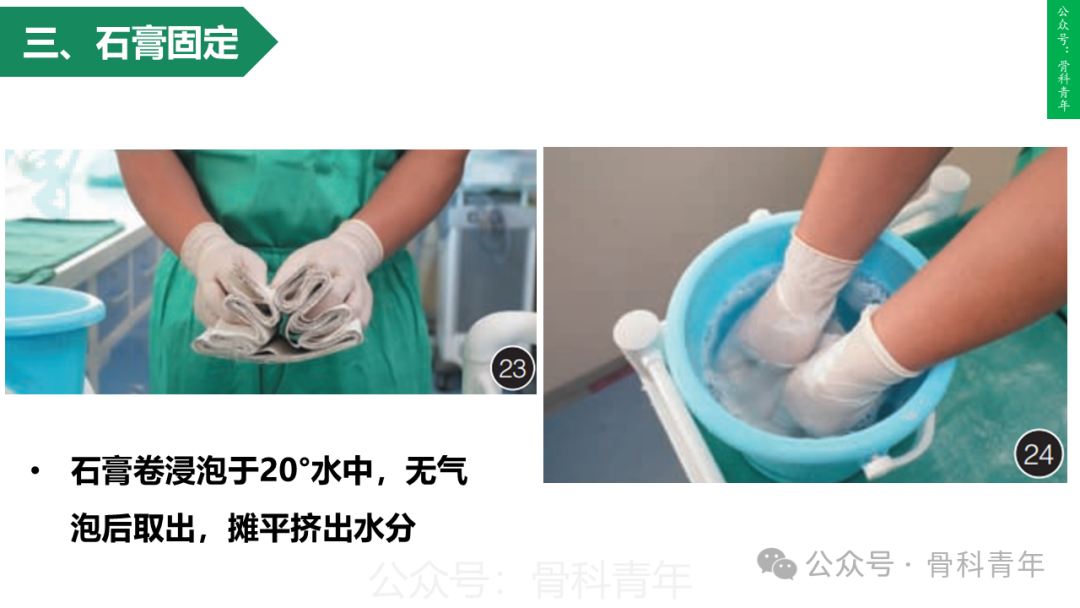 积水潭教程：桡骨远端骨折闭合整复石膏固定操作流程