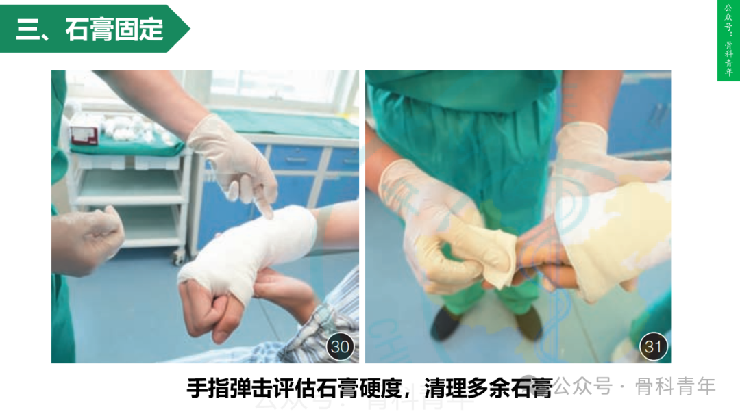 积水潭教程：桡骨远端骨折闭合整复石膏固定操作流程