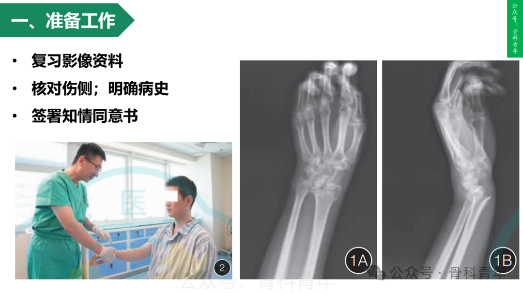 积水潭教程：桡骨远端骨折闭合整复石膏固定操作流程