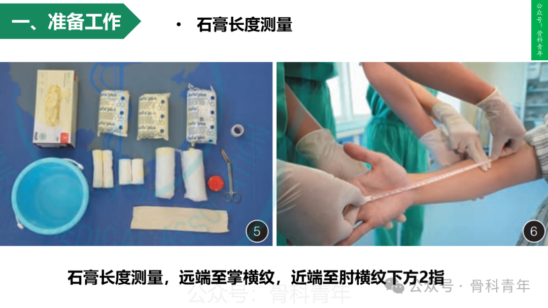 积水潭教程：桡骨远端骨折闭合整复石膏固定操作流程