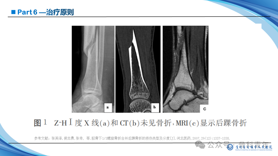 张-侯氏（Z-H）骨折的损伤机制、诊断与治疗