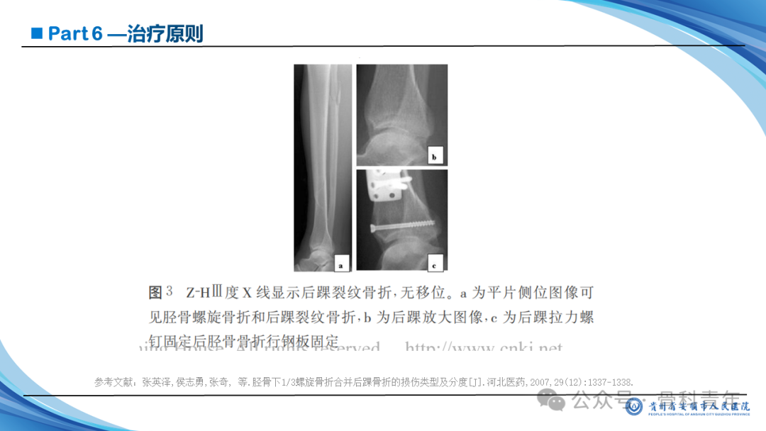 张-侯氏（Z-H）骨折的损伤机制、诊断与治疗