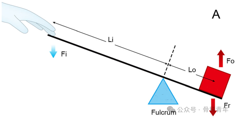 手术技巧｜“血管钳撬拨技术”辅助复位粗隆下骨折