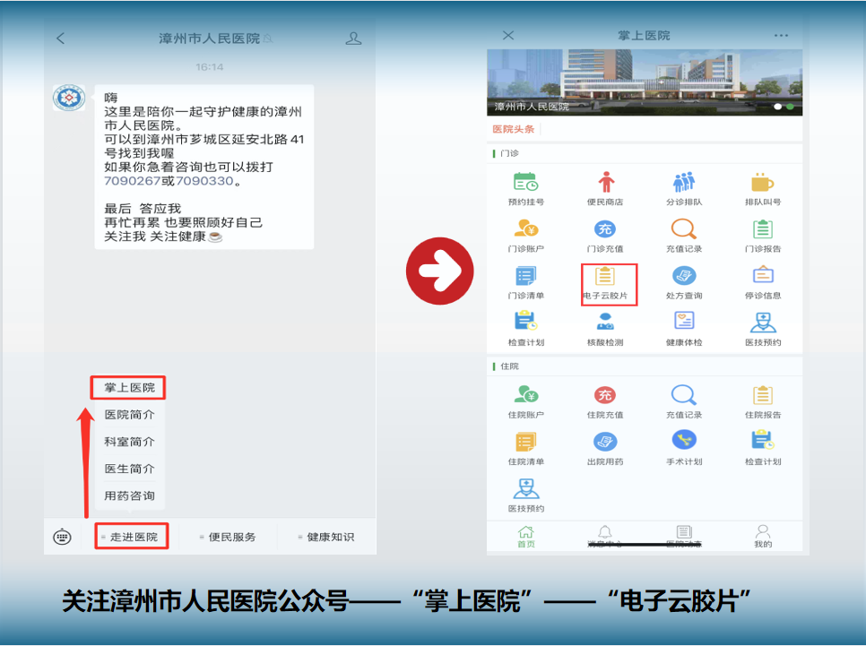 怎么自助取胶片医院【便民服务】手机可以查阅影像报告啦！漳州市人民医院“云胶片”服务已上线_https://www.jmylbn.com_新闻资讯_第9张