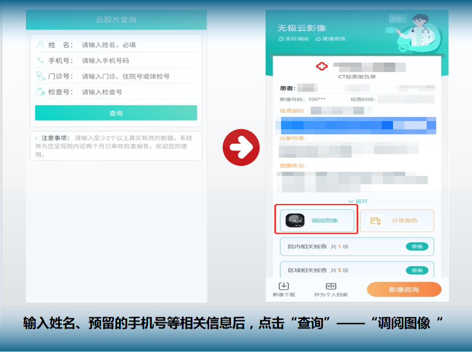 怎么自助取胶片医院【便民服务】手机可以查阅影像报告啦！漳州市人民医院“云胶片”服务已上线_https://www.jmylbn.com_新闻资讯_第10张