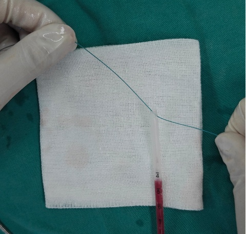prolene缝线 打结时为什么要喷水曼月乐环总掉？缝合固定术的“10个关键技巧”全公开！从缝线选针到打结，手把手教学_https://www.jmylbn.com_新闻资讯_第8张