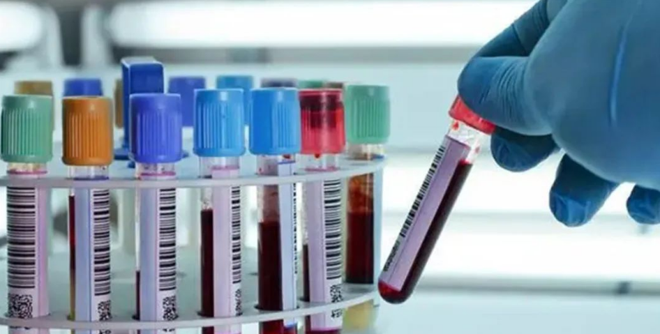 香港邮寄验血全是假的_邮寄香港验血怎么保证真实性_香港邮寄验血被骗的案例