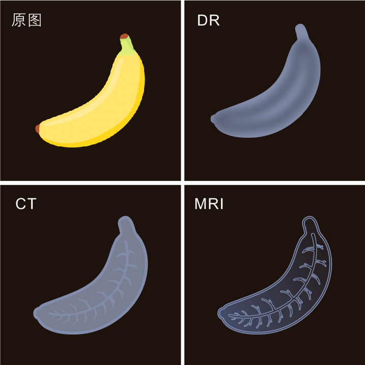 医学影像dr是什么DR／CT／MRI：影像科三兄弟如何区分_https://www.jmylbn.com_新闻资讯_第7张