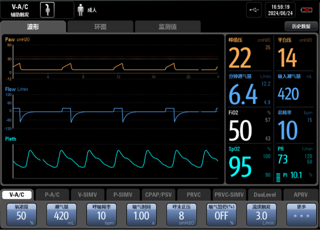 容控模式怎么表示问答：容控模式是容量切换吗？_https://www.jmylbn.com_新闻资讯_第2张