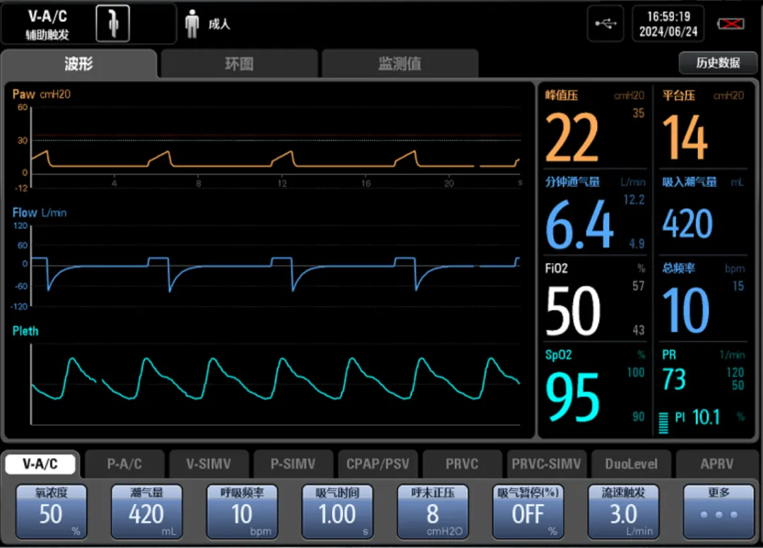 容控模式怎么表示问答:容控模式是容量切换吗?_新闻资讯_第2张_活检穿刺产品网 容控模式怎么表示问答:容控模式是容量切换吗?_https://www.jmylbn.com_新闻资讯_第2张