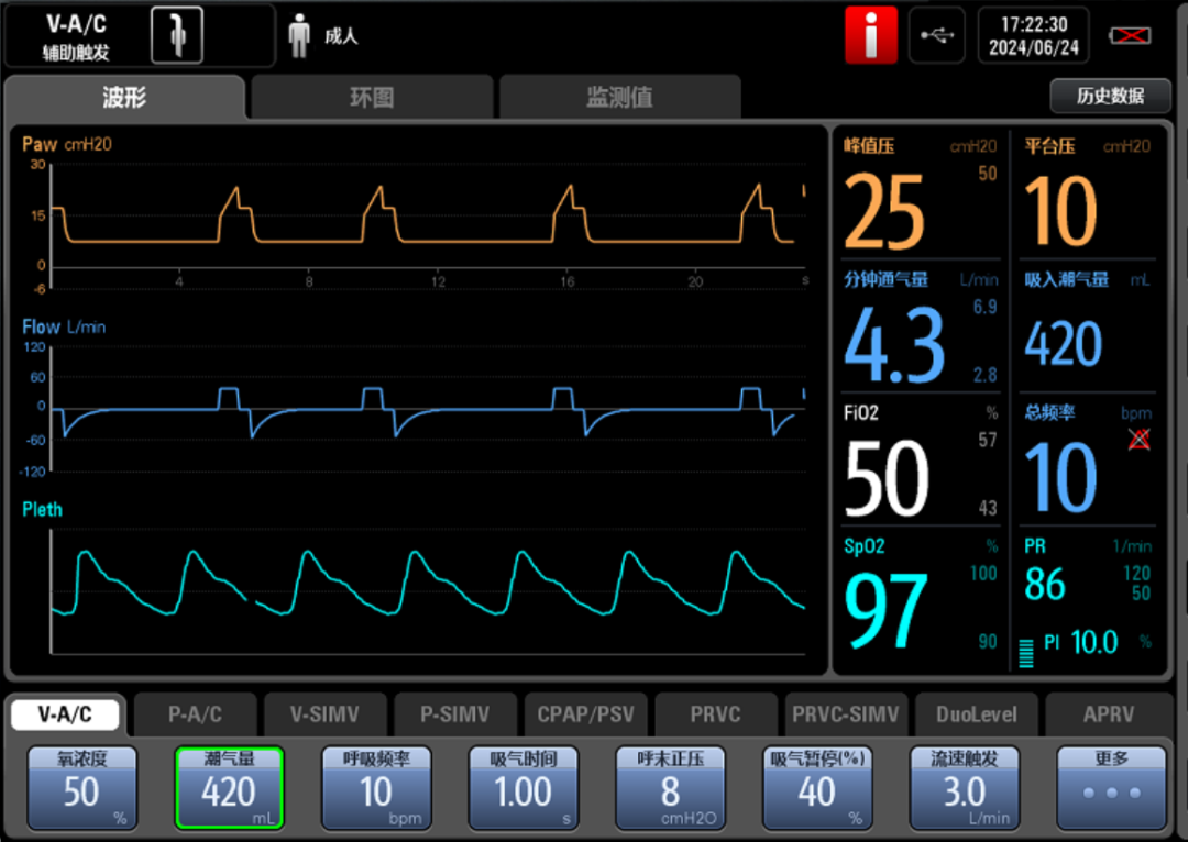 容控模式怎么表示问答：容控模式是容量切换吗？_https://www.jmylbn.com_新闻资讯_第3张