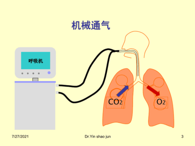 缺氧 医疗机怎么用【健康科普】生命的呼吸：走进吸氧治疗的奥秘_https://www.jmylbn.com_新闻资讯_第4张