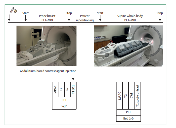 文献速递：PET-影像组学专题--临床上在乳腺癌方面PET-MRI的进展 - 影像组学科研世界 | 国内第一个影像组学论坛