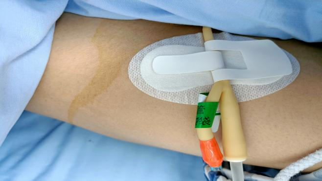 留置引流导管是什么【护理天地】留置导尿管的护理注意事项_https://www.jmylbn.com_新闻资讯_第8张