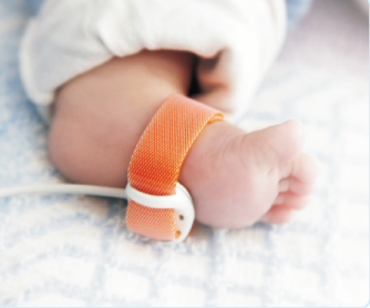 为什么新生儿的监护仪您了解血流灌注指数吗？_https://www.jmylbn.com_新闻资讯_第6张