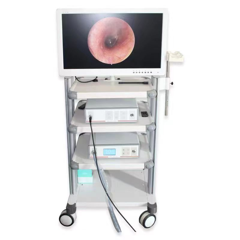 耳鼻喉内窥镜检查是检查什么什么是耳鼻喉内窥镜_https://www.jmylbn.com_新闻资讯_第3张