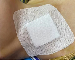 微波针是什么以“针”代“刀”，带你了解甲状腺结节微波消融术_https://www.jmylbn.com_新闻资讯_第7张