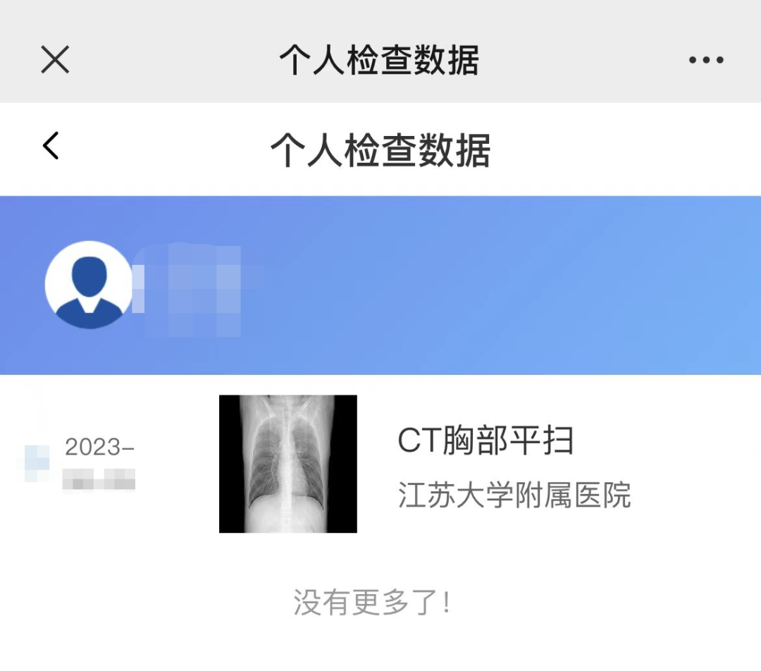 医用ct胶片怎么收纳告别“胶片时代”，CT片手机可以轻松查_https://www.jmylbn.com_新闻资讯_第13张
