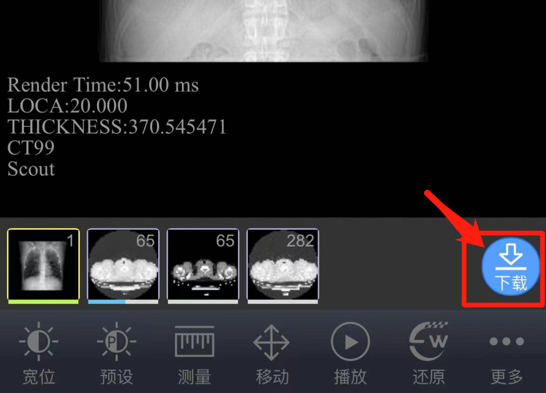 医用ct胶片怎么收纳告别“胶片时代”，CT片手机可以轻松查_https://www.jmylbn.com_新闻资讯_第16张
