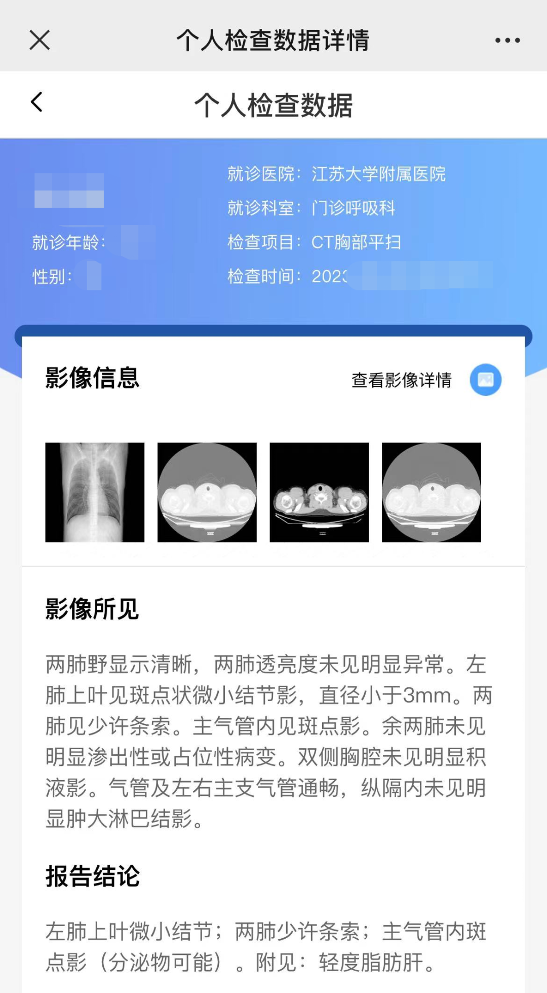 医用ct胶片怎么收纳告别“胶片时代”，CT片手机可以轻松查_https://www.jmylbn.com_新闻资讯_第14张