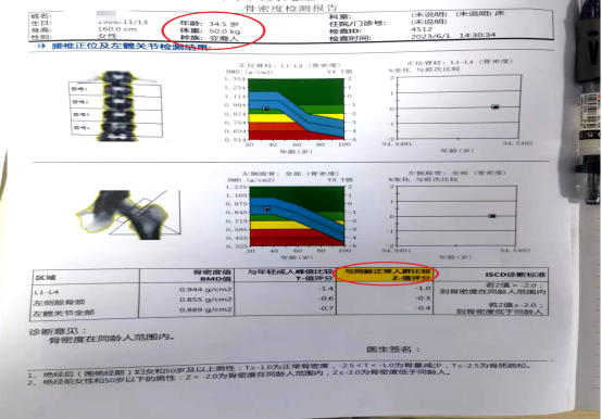 成人怎么检测骨密度骨质疏松并非老年人“专属”，这项检查所有成年人都该重视！_https://www.jmylbn.com_新闻资讯_第4张