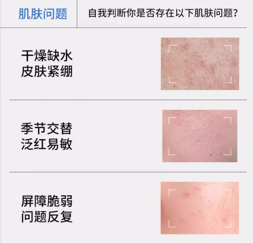 什么是医用膜什么是医用面膜？你对医用面膜了解多少？_https://www.jmylbn.com_新闻资讯_第3张