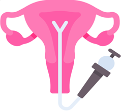 宫腔镜器械怎么安装七院科普丨检查子宫内部的“明灯”——宫腔镜的“前世今生”_https://www.jmylbn.com_新闻资讯_第3张