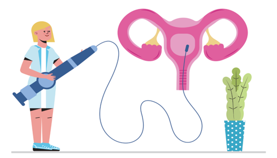 宫腔镜器械怎么安装七院科普丨检查子宫内部的“明灯”——宫腔镜的“前世今生”_https://www.jmylbn.com_新闻资讯_第5张