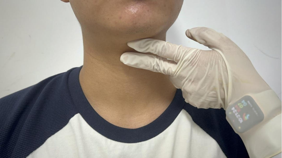 为什么要做吞咽仪器吞咽障碍评定_https://www.jmylbn.com_新闻资讯_第5张